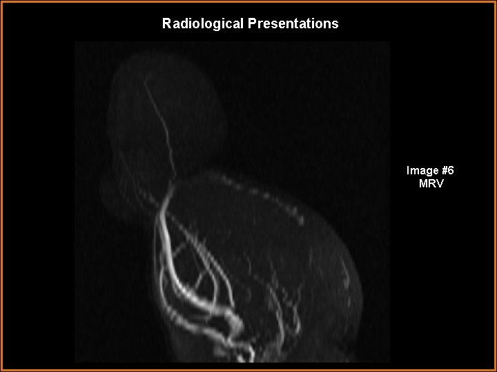 Radiological Presentations Image #6 MRV 