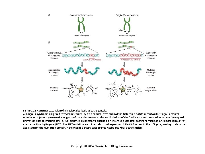 Figure 21. 6 Abnormal expansion of trinucleotides leads to pathogenesis. A. Fragile X syndrome