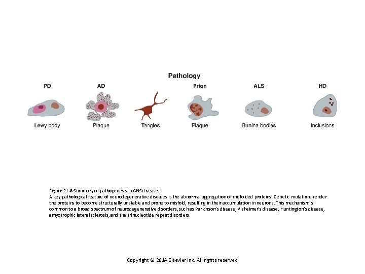Figure 21. 8 Summary of pathogenesis in CNS diseases. A key pathological feature of