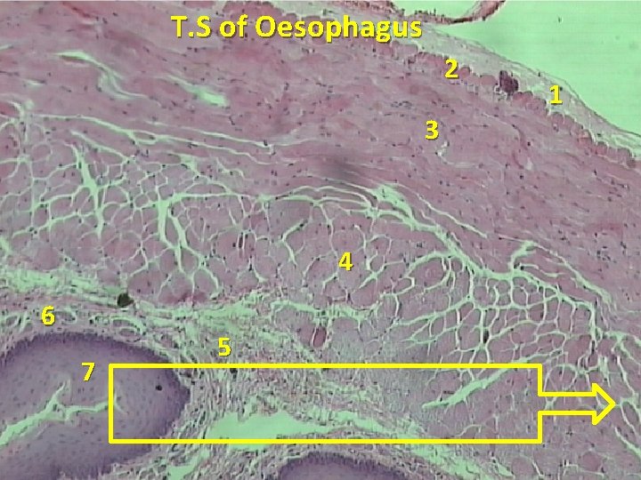 T. S of Oesophagus 2 3 4 6 7 5 1 
