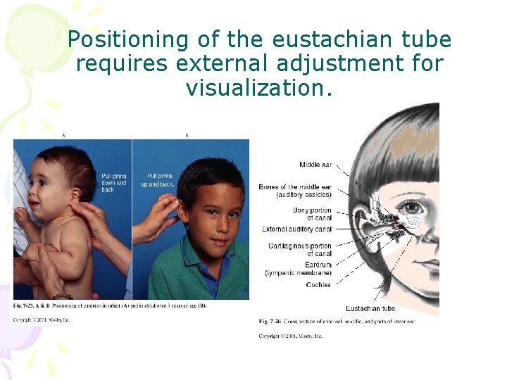 Positioning of the eustachian tube requires external adjustment for visualization. 