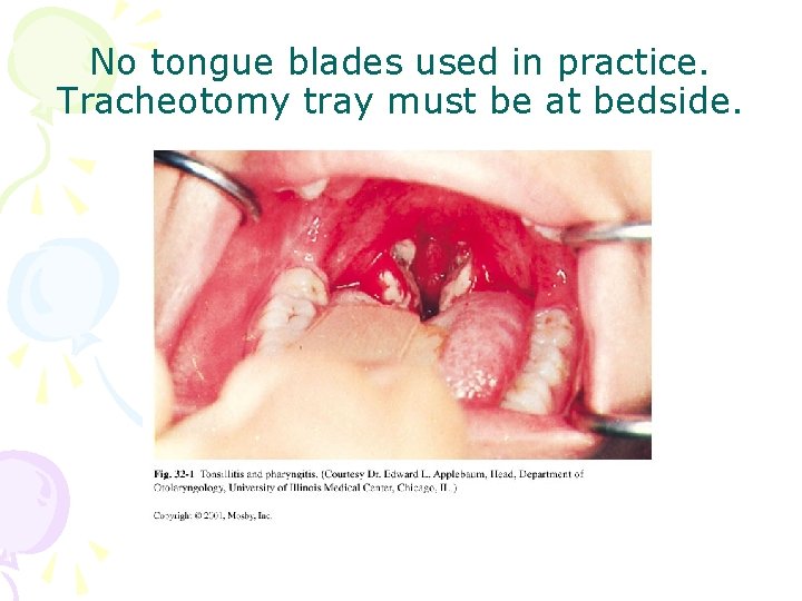 No tongue blades used in practice. Tracheotomy tray must be at bedside. 