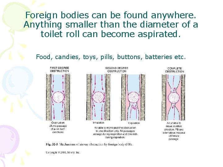 Foreign bodies can be found anywhere. Anything smaller than the diameter of a toilet