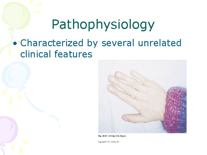 Pathophysiology • Characterized by several unrelated clinical features 