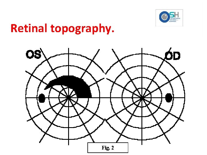 Retinal topography. 