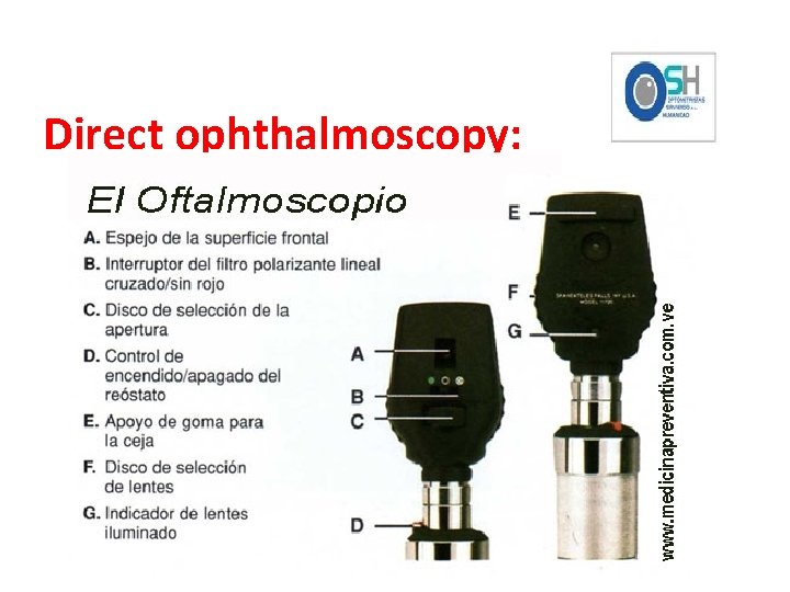 Direct ophthalmoscopy: 