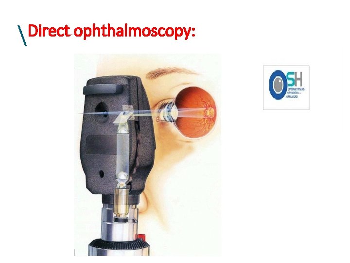 Direct ophthalmoscopy:  