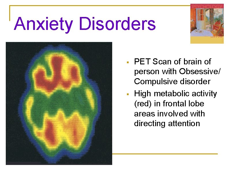 Anxiety Disorders § § PET Scan of brain of person with Obsessive/ Compulsive disorder Anxiety Disorders § § PET Scan of brain of person with Obsessive/ Compulsive disorder
