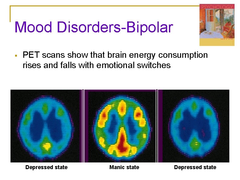 Mood Disorders-Bipolar § PET scans show that brain energy consumption rises and falls with Mood Disorders-Bipolar § PET scans show that brain energy consumption rises and falls with