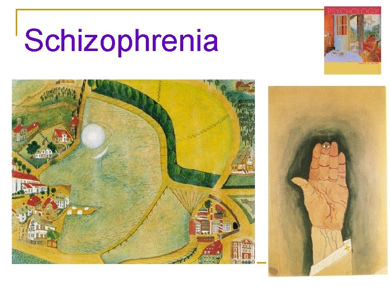 Schizophrenia Schizophrenia