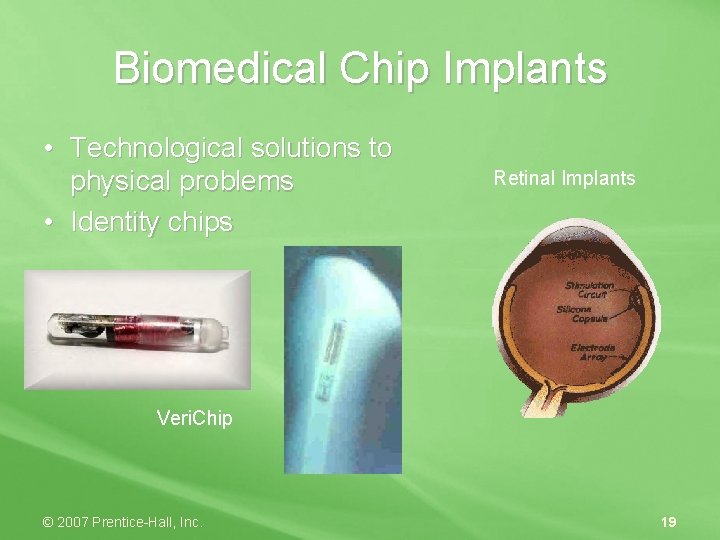 Biomedical Chip Implants • Technological solutions to physical problems • Identity chips Retinal Implants