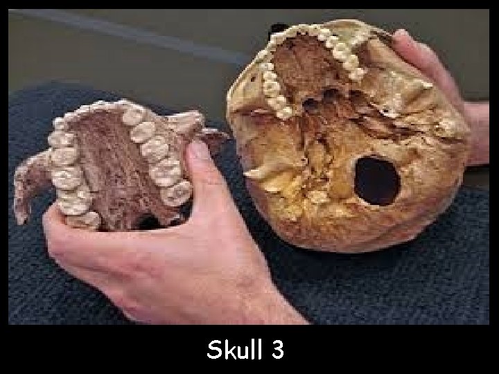 Skull 3 