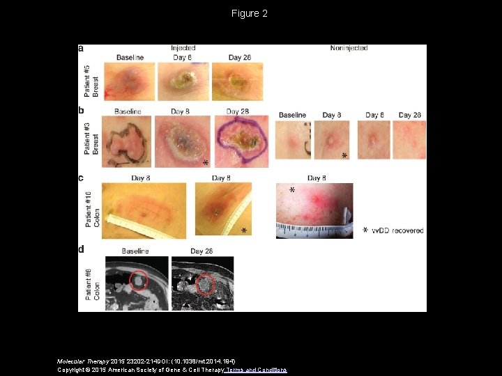 Figure 2 Molecular Therapy 2015 23202 -214 DOI: (10. 1038/mt. 2014. 194) Copyright ©