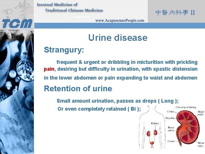 Urine disease Strangury: frequent & urgent or dribbling in micturition with prickling pain, desiring