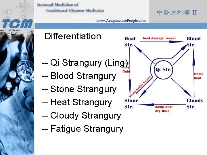 Differentiation -- Qi Strangury (Ling) -- Blood Strangury -- Stone Strangury -- Heat Strangury