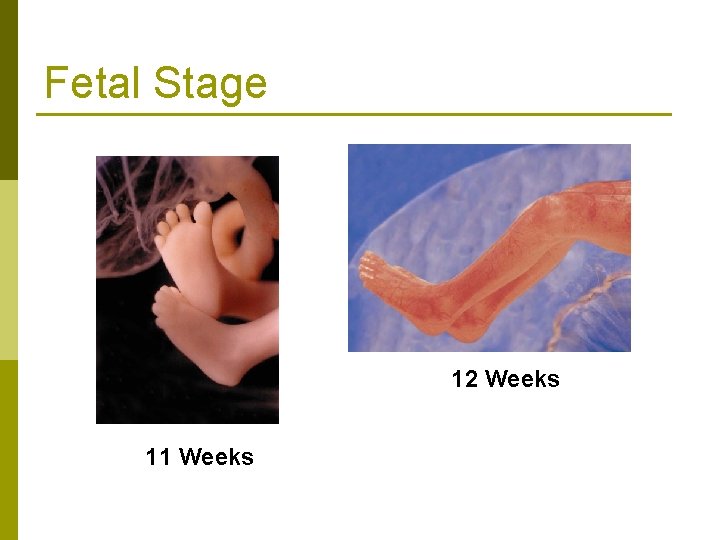 Fetal Stage 12 Weeks 11 Weeks 