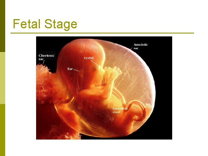 Fetal Stage 