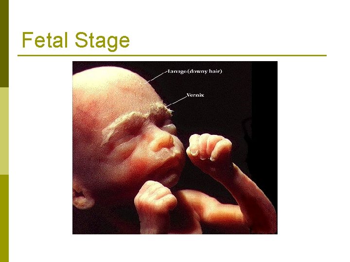 Fetal Stage 