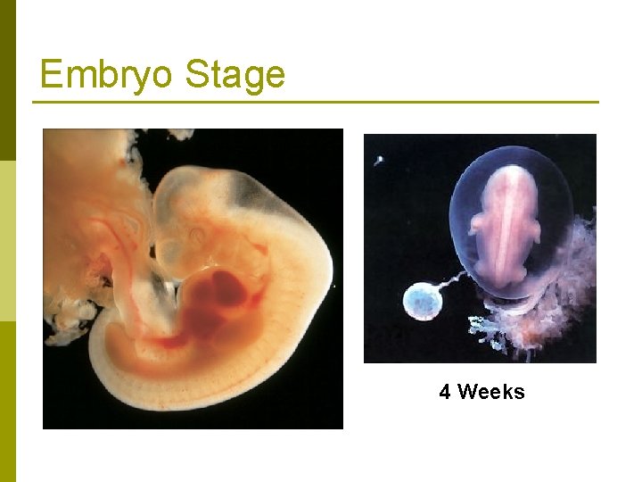 Embryo Stage 4 Weeks 