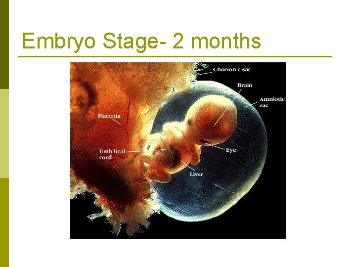 Embryo Stage- 2 months 