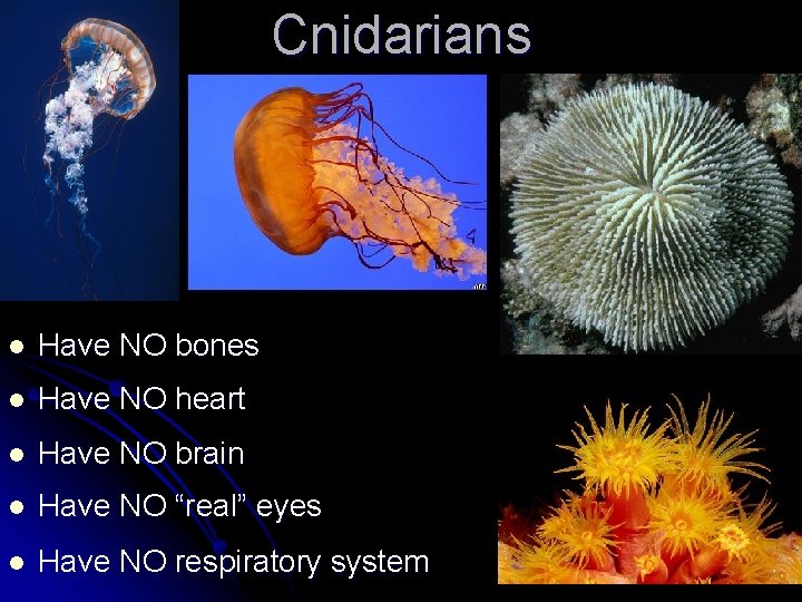 Cnidarians l Have NO bones l Have NO heart l Have NO brain l