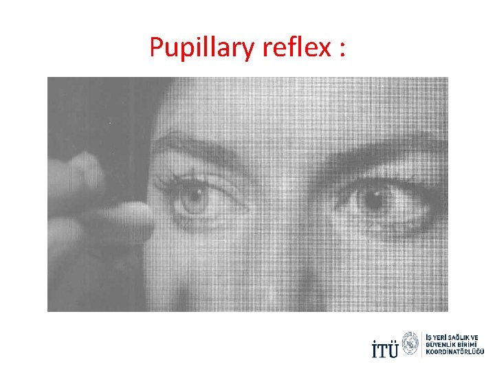 Pupillary reflex : 