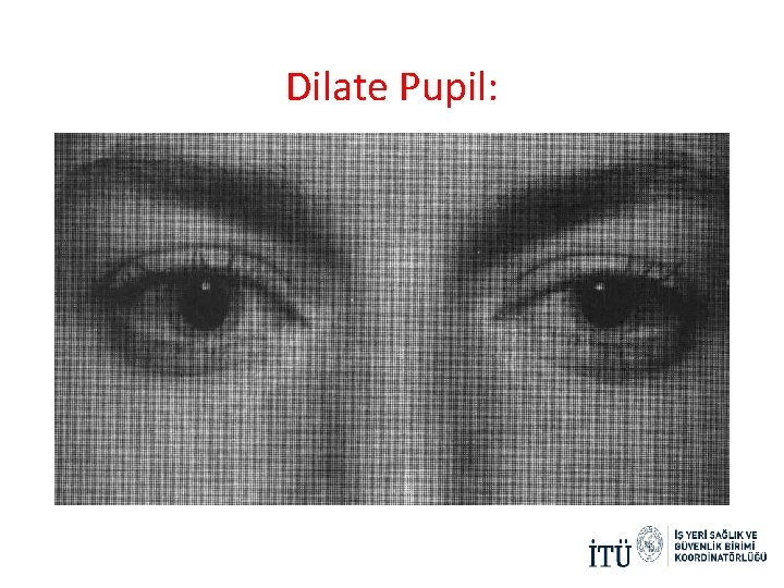 Dilate Pupil: Dilate Pupil: