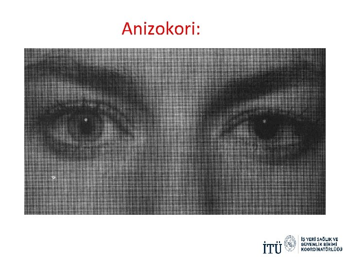 Anizokori: Anizokori: