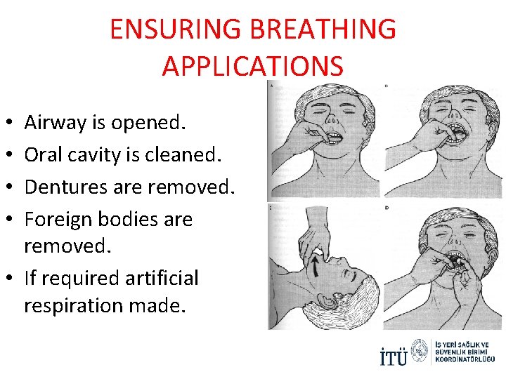 ENSURING BREATHING APPLICATIONS Airway is opened. Oral cavity is cleaned. Dentures are removed. Foreign