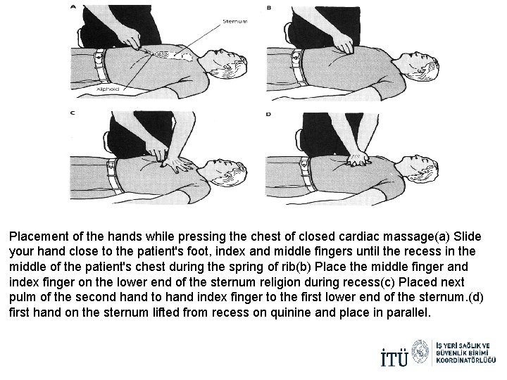 Placement of the hands while pressing the chest of closed cardiac massage(a) Slide your