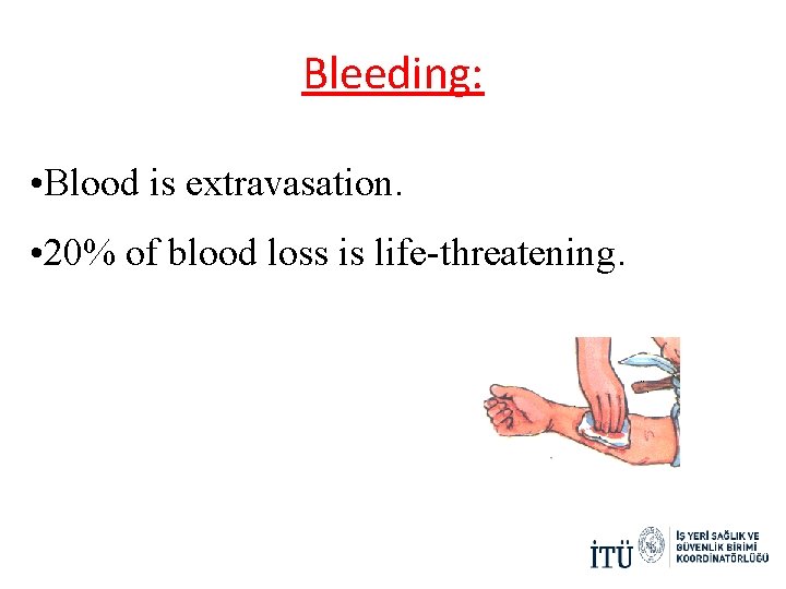 Bleeding: • Blood is extravasation. • 20% of blood loss is life-threatening. Bleeding: • Blood is extravasation. • 20% of blood loss is life-threatening.