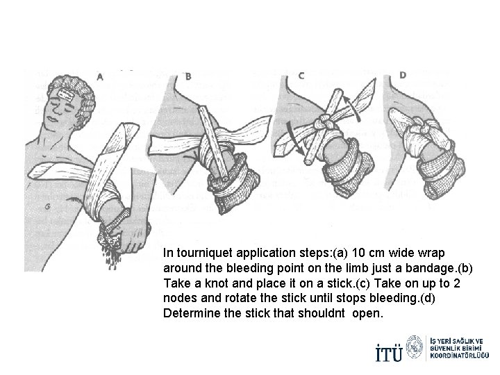 In tourniquet application steps: (a) 10 cm wide wrap around the bleeding point on