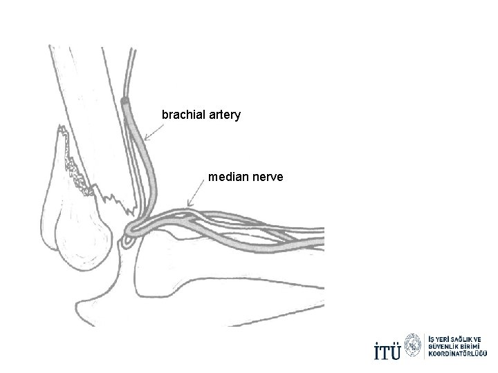 brachial artery median nerve brachial artery median nerve