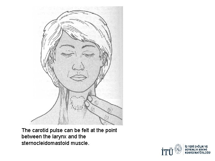 The carotid pulse can be felt at the point between the larynx and the