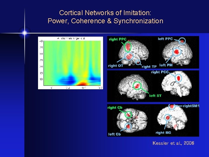 Cortical Networks of Imitation: Power, Coherence & Synchronization Kessler et al. , 2006 