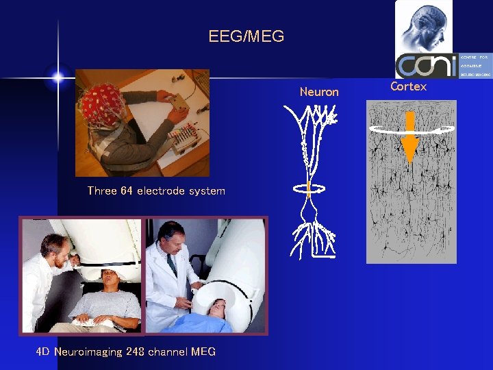 EEG/MEG Neuron Three 64 electrode system 4 D Neuroimaging 248 channel MEG Cortex 