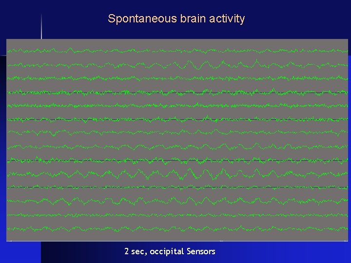 Spontaneous brain activity 2 sec, occipital Sensors 