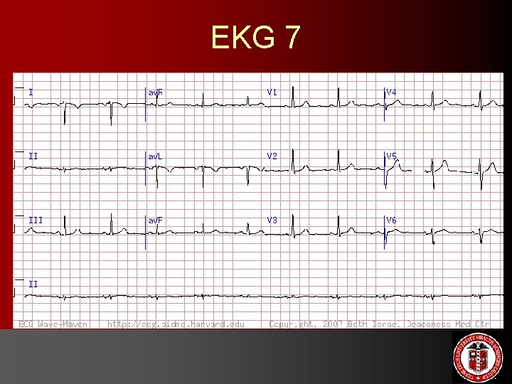 EKG 7 