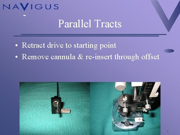 Parallel Tracts • Retract drive to starting point • Remove cannula & re-insert through