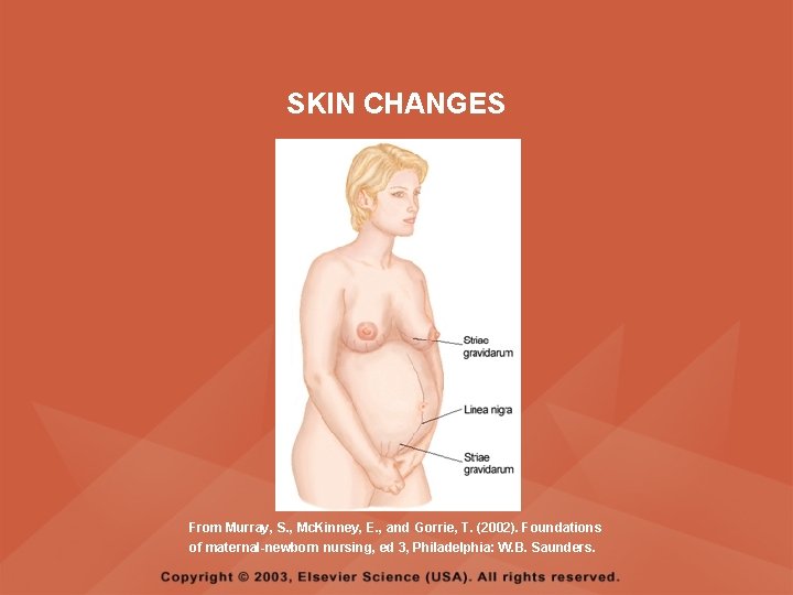 SKIN CHANGES From Murray, S. , Mc. Kinney, E. , and Gorrie, T. (2002).