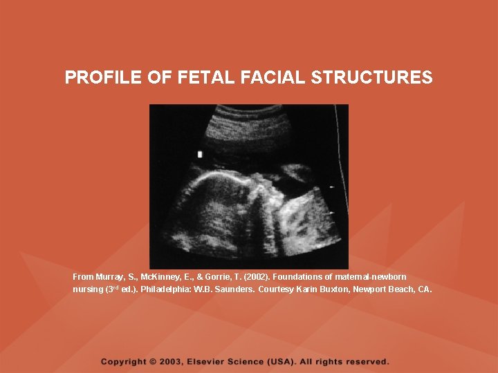 PROFILE OF FETAL FACIAL STRUCTURES From Murray, S. , Mc. Kinney, E. , &