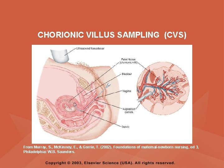 CHORIONIC VILLUS SAMPLING (CVS) From Murray, S. , Mc. Kinney, E. , & Gorrie,