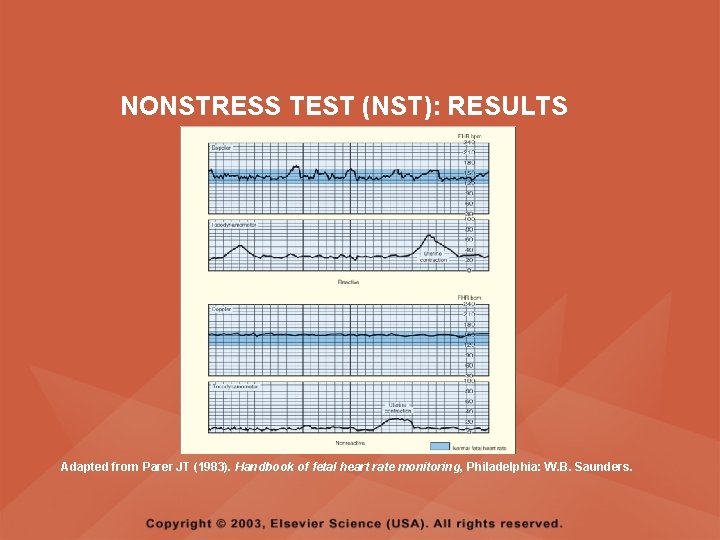 NONSTRESS TEST (NST): RESULTS Adapted from Parer JT (1983). Handbook of fetal heart rate