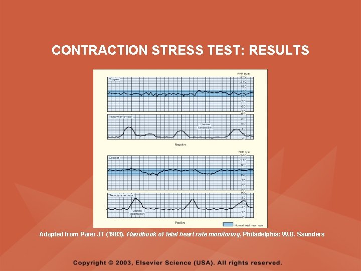 CONTRACTION STRESS TEST: RESULTS Adapted from Parer JT (1983). Handbook of fetal heart rate