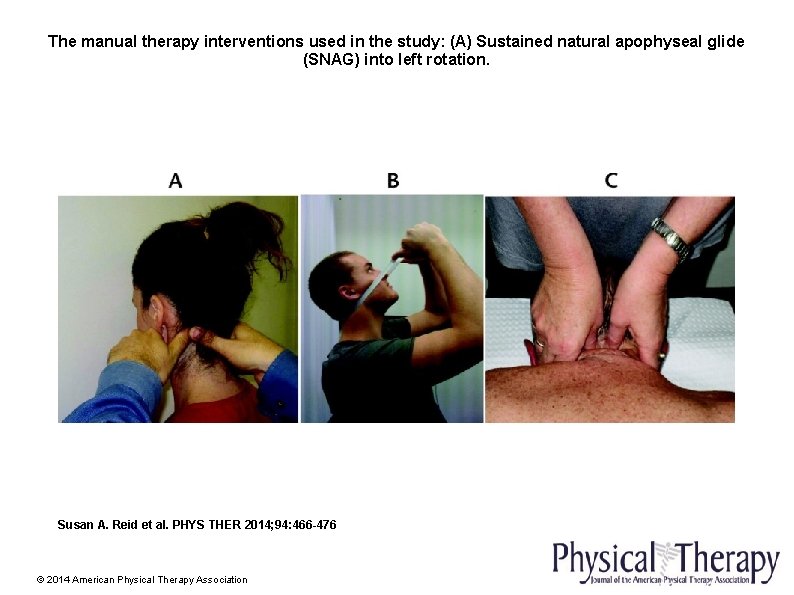 The manual therapy interventions used in the study: (A) Sustained natural apophyseal glide (SNAG)