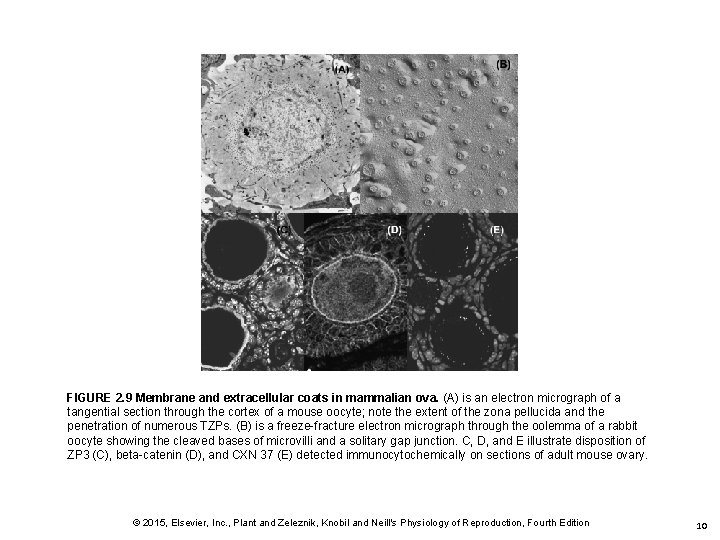 FIGURE 2. 9 Membrane and extracellular coats in mammalian ova. (A) is an electron