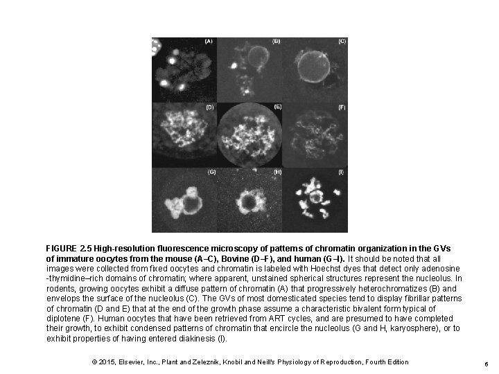 FIGURE 2. 5 High-resolution fluorescence microscopy of patterns of chromatin organization in the GVs