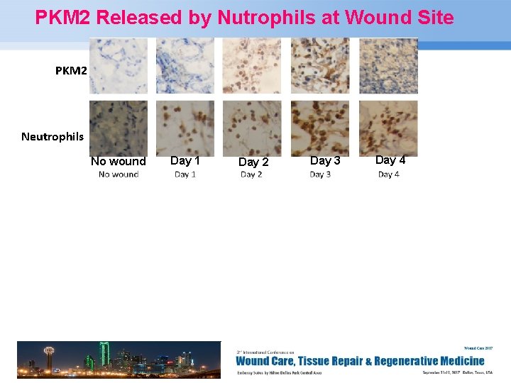 PKM 2 Released by Nutrophils at Wound Site PKM 2 Neutrophils No wound Page