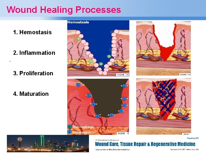 Wound Healing Processes 1. Hemostasis 2. Inflammation. 3. Proliferation 4. Maturation Page 7 