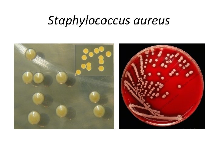 Staphylococcus aureus 